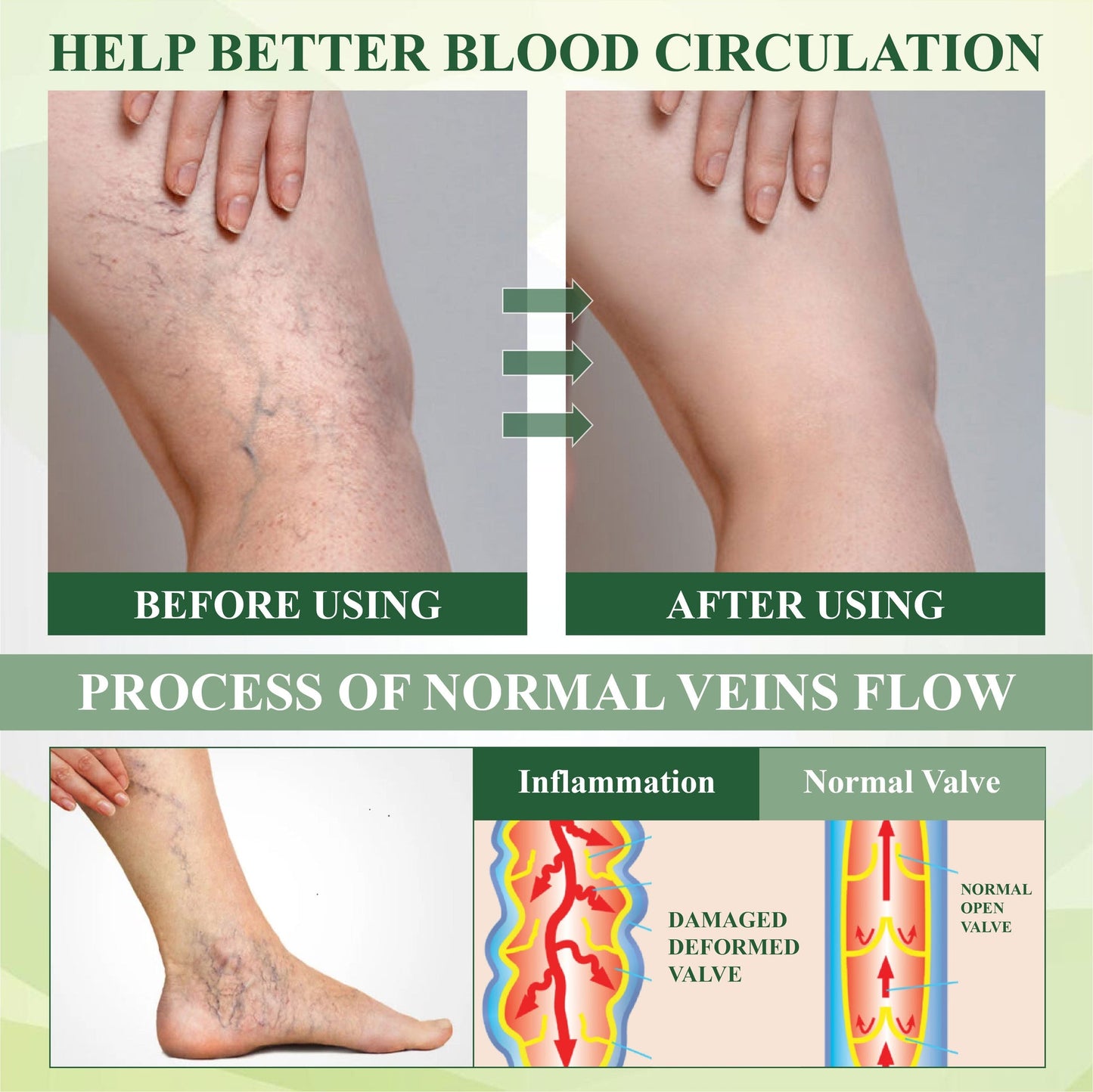 TAILEDEN™ FluidEase Leg Therapy Edema Cream