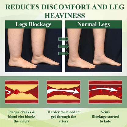 TAILEDEN™ FluidEase Leg Therapy Edema Cream