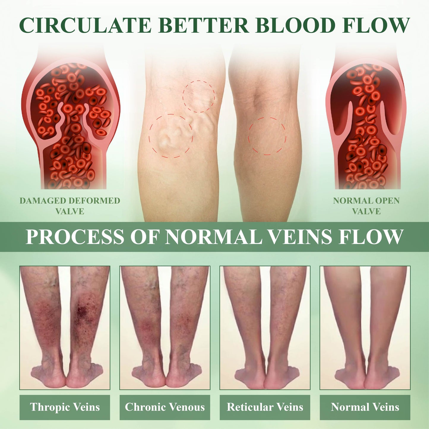TAILEDEN™ FluidEase Leg Therapy Edema Cream