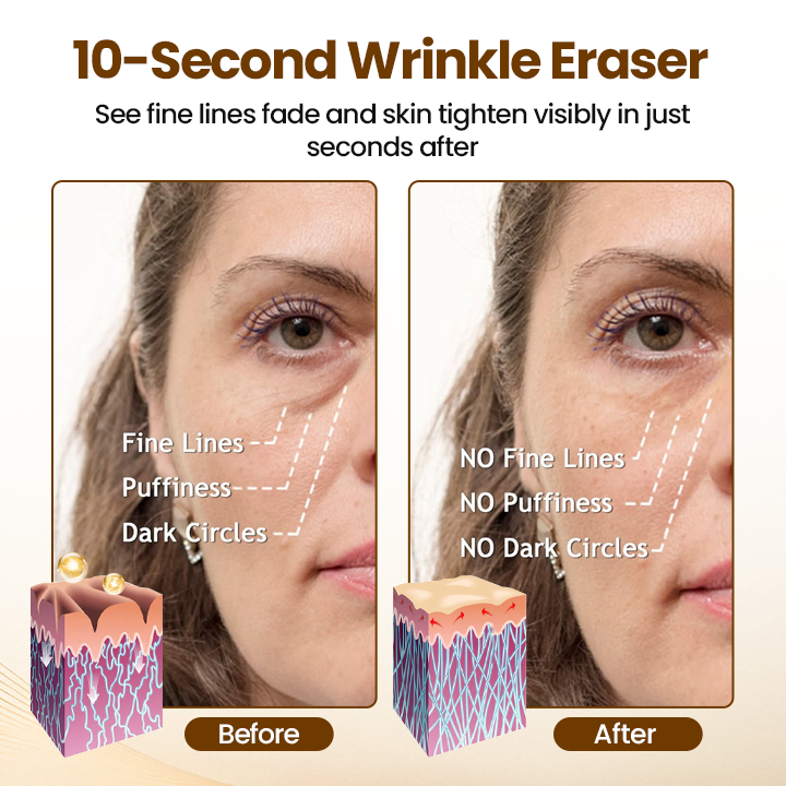 Lovilds® 10s Wrinkle Serum