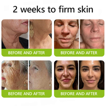 [🌸 Mother's Day Sale 70% OFF] ODALIT™ Botox & Retinol Shot - Eraser for Deep Wrinkles, Sagging Jowls & Puffy Eyes
