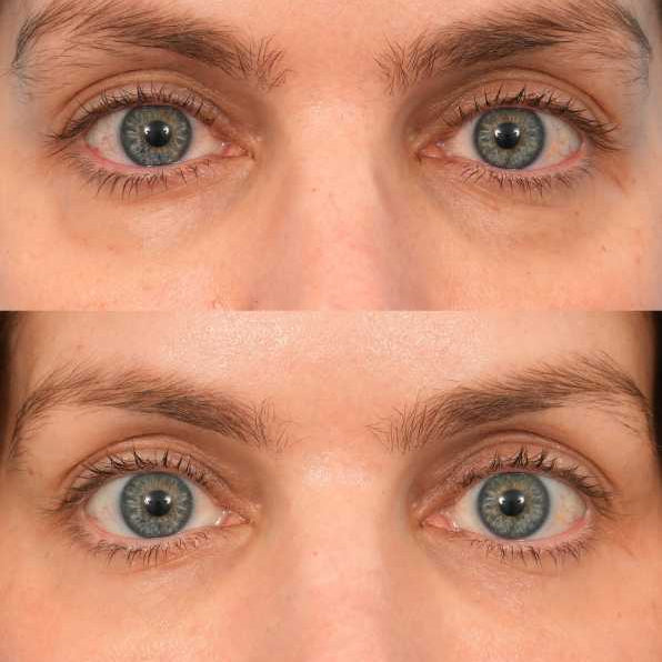 ✨ Instantly awaken your skin! LOVILDS™ Peptide Collagen Hydrating Eye Patches — Reduce eye bags & dark circles in 5 minutes