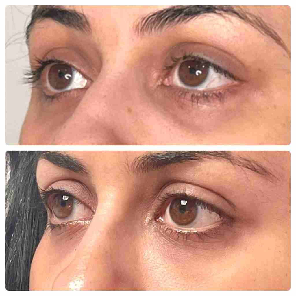 ✨ Instantly awaken your skin! LOVILDS™ Peptide Collagen Hydrating Eye Patches — Reduce eye bags & dark circles in 5 minutes
