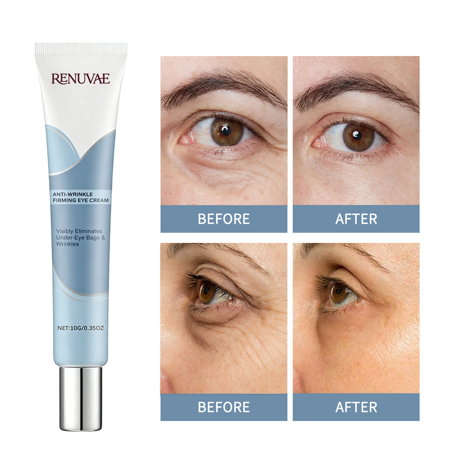 Renuvae™ Instant Face Temporary Tightener – Instant visible results in 30 seconds